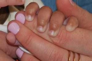 post-adoption birthmother story